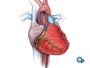 Next, the doctor uses the catheter to inject a dye into the artery itself. The die shows up on a TV monitor and is used to pinpoint the exact location of the blocked area.