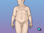 By recommending gastric bypass, your doctor is telling you that dieting is not a reasonable solution to your weight problem. More drastic measures are necessary.Should you choose not to undergo gastric bypass surgery and you continue to be obese, you will most certainly be placing your health at risk.