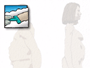In the operating room, a nurse will begin preparation by clipping or shaving the abdomen.