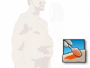 The surgeon will then apply antiseptic solution to the skin . . .