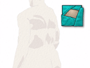 ... and place a sterile drape around the operative site.