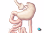 The other free end of the intestine is surgically stitched to the side of an intestinal loop.