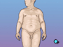 But because gastric bypass calls for dietary and lifestyle changes patients risk other health problems if they choose not follow their doctor's eating and dietary instructions.