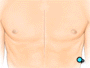 Then, your doctor will make a vertical incision in the center of the chest.