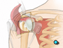 Under the deltoid muscle lies the bursa, a protective sac that prevents the rotator cuff tendons and the shoulder muscles from rubbing against each other.