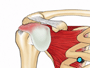 Under the deltoid muscle lies the bursa, a protective sac that prevents the rotator cuff tendons and the shoulder muscles from rubbing against each  other.